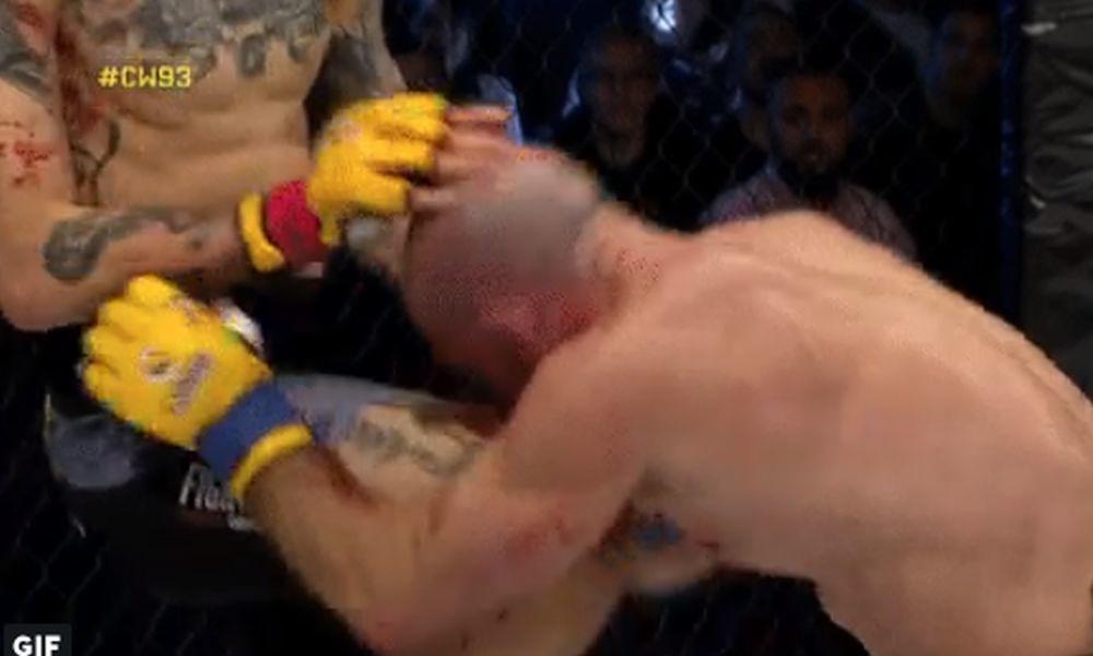 Brutalan nokaut izazvao jednu od najjezivijih povreda u historiji MMA