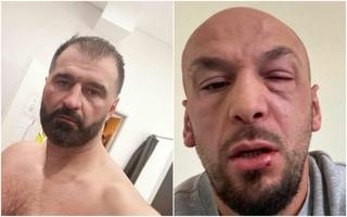 Uhapšen kikbokser Adnan Redžović zbog napada na Iron Pukija