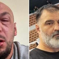 Oglasio se MUP KS: Novi detalji o sukobu Irona Pukija i Adnana Redžovića
