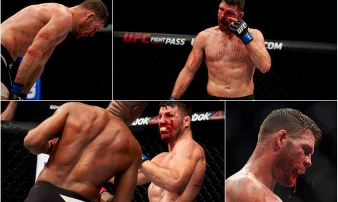 Nakon što mu je u krvavoj borbi stradalo oko, zvijezda UFC-a se povlači: Sijevalo mi je pred očima, počeo sam paničiti