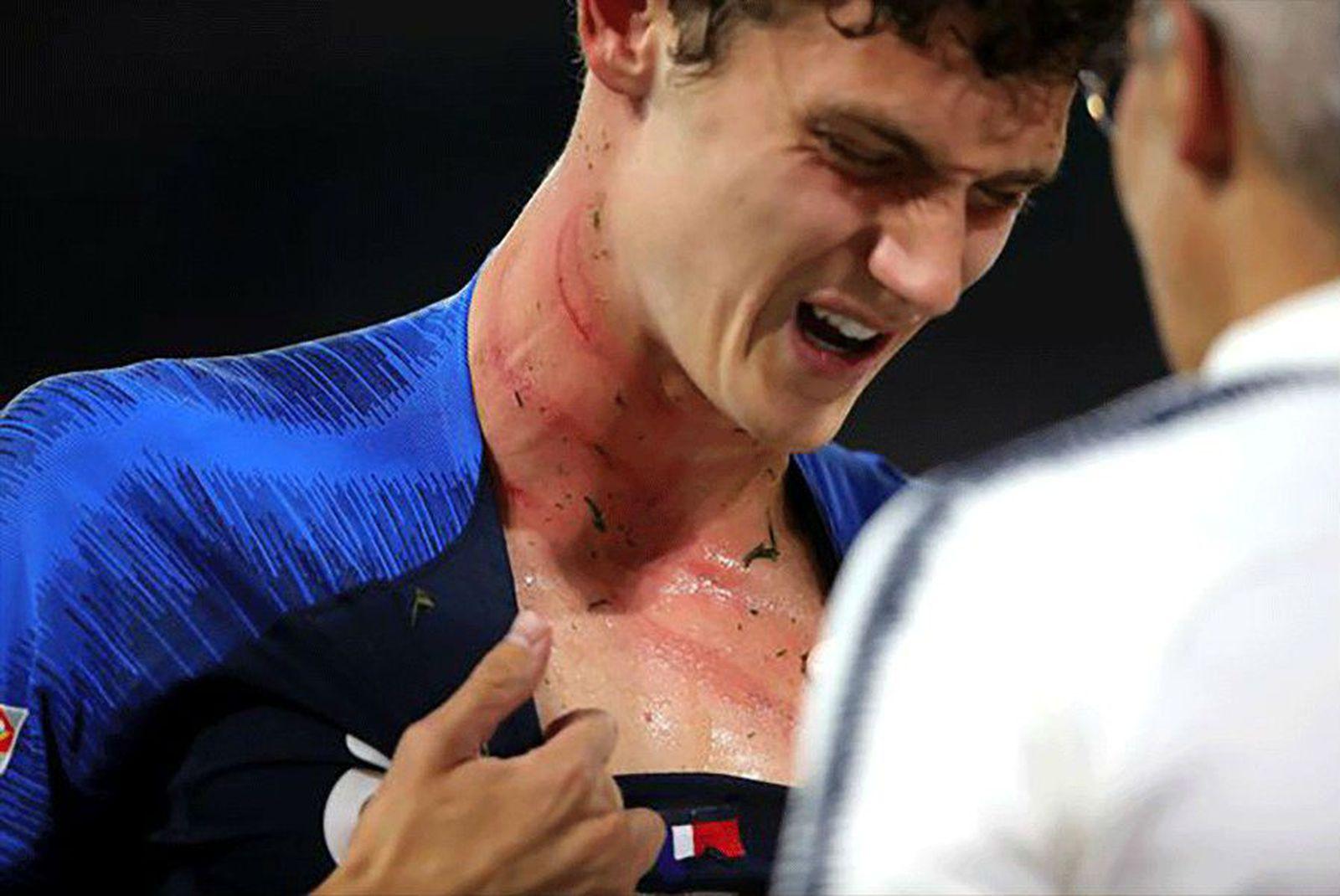 Liga nacija započela krvavo: Pogledajte brutalan start na francuskog reprezentativca