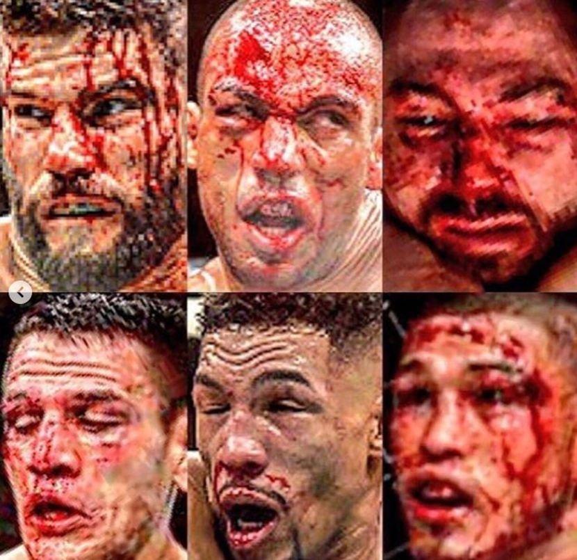 Ovako su poslije borbe izgledala lica poslednjih 6 protivnika Tonija Fergusona u UFC-u - Avaz
