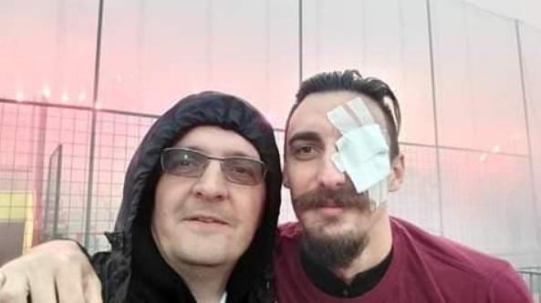 Miloš Stanojević jučer u Beogradu operirao oko, danas vodio navijanje