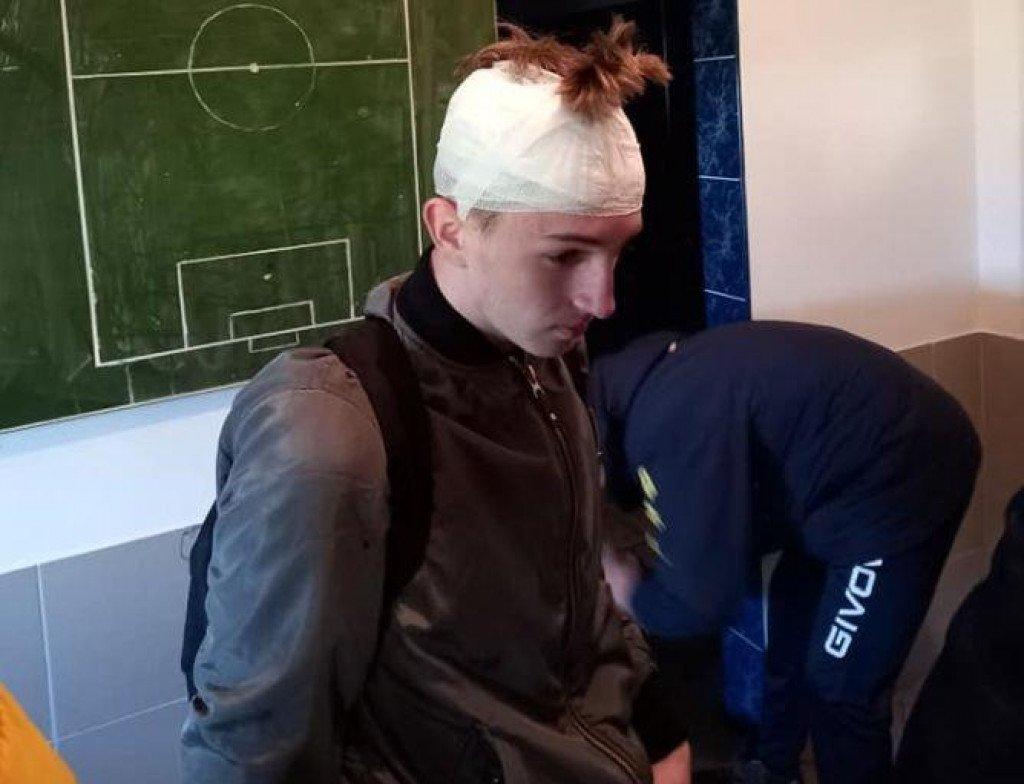 Mladi fudbaler pogođen flašom u glavu