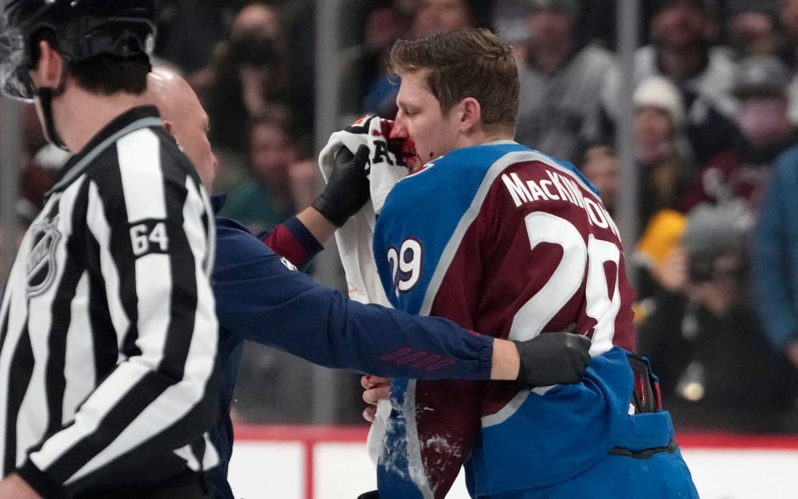 NHL: Hokejaš Kolorada doživio tešku povredu lica