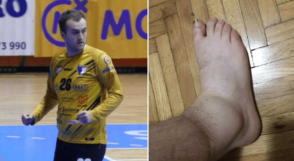 Golman Iskre iz Bugojna povrijeđen branio: Pogledajte u kakvom stanju je njegova noga