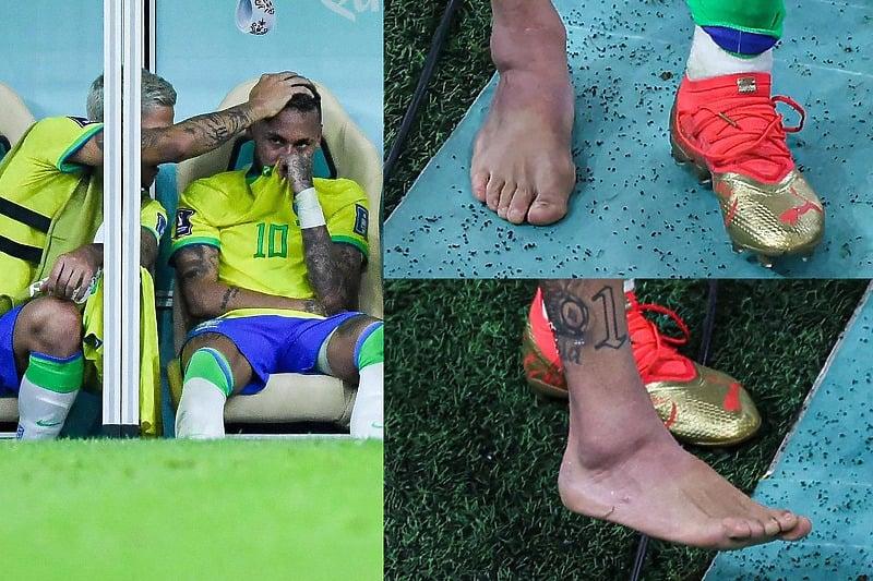 Povreda Nejmara zabrinula Brazilce, ali ne i selektora Titea