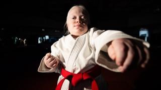 Želja albino djevojčice Bejze je postati prvak Evrope u karateu
