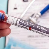 Sumnja se da je u Evropu stigla Marburška bolest: Smrtnost 88 posto 