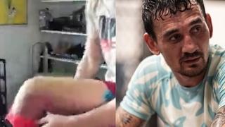Video /  Maks Holovej pokazao kako mu izgleda noga nakon borbe s Gejdžijem: "Tip udara kao kamion"