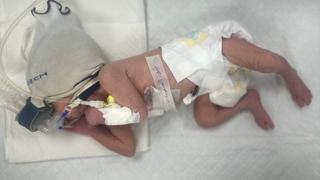 Beba trudnice koja je ubijena u izraelskom napadu pod medicinskom njegom
