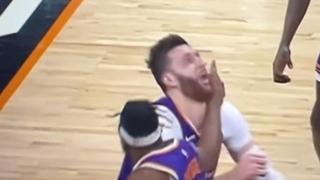 Video / Bizarna povreda Nurkića: Udario ga saigrač